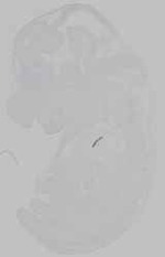 EMAGE:14818