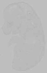 EMAGE:14831