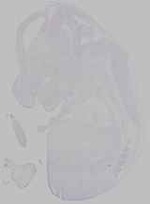 EMAGE:14852