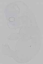 EMAGE:14852