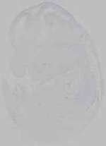 EMAGE:14855