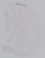EMAGE:14868