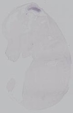 EMAGE:14868
