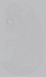 EMAGE:14873