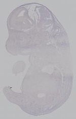 EMAGE:14874
