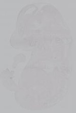 EMAGE:14874