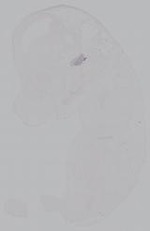 EMAGE:14878