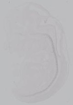 EMAGE:14894