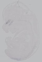 EMAGE:14894