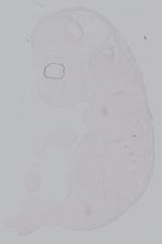 EMAGE:14894