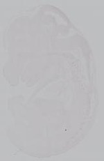 EMAGE:14896
