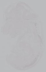 EMAGE:14899