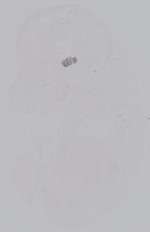 EMAGE:14902