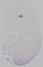 EMAGE:14902
