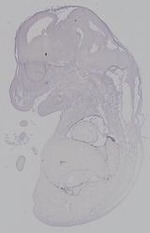 EMAGE:14904