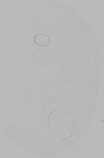 EMAGE:14904
