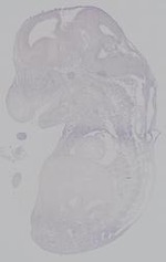 EMAGE:14905