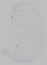 EMAGE:14908