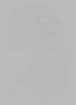 EMAGE:14914