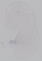 EMAGE:14914