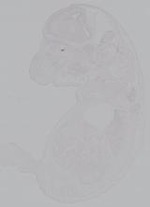 EMAGE:14917
