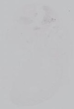 EMAGE:14919