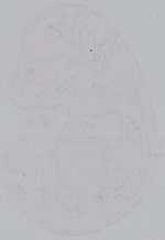EMAGE:14922