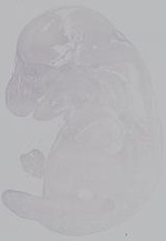 EMAGE:14926
