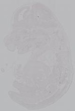 EMAGE:14926