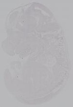 EMAGE:14929