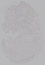 EMAGE:14929