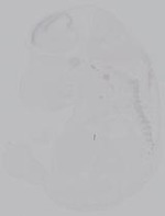 EMAGE:14931