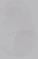 EMAGE:14934