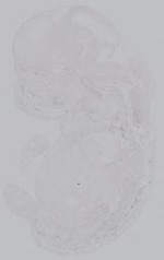 EMAGE:14941