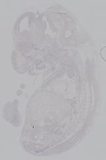 EMAGE:14943