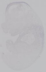 EMAGE:14944