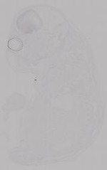 EMAGE:14952