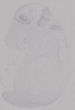 EMAGE:14952