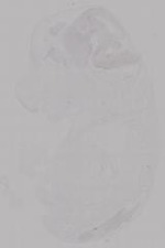 EMAGE:14952