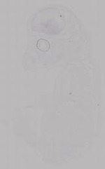EMAGE:14952