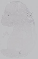EMAGE:14953