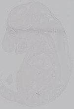 EMAGE:14953