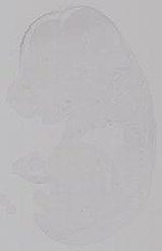 EMAGE:14953