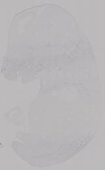 EMAGE:14953