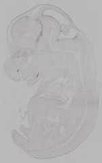 EMAGE:14956