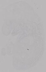EMAGE:14957
