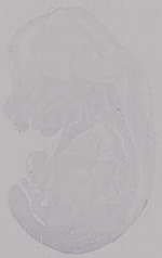 EMAGE:14957