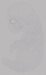 EMAGE:14957