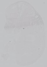 EMAGE:14959