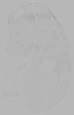 EMAGE:14961